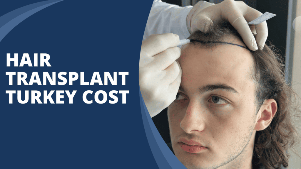 Hair Transplant Turkey Cost
