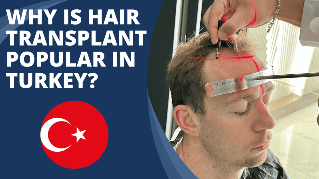Why is hair transplant popular in Turkey?