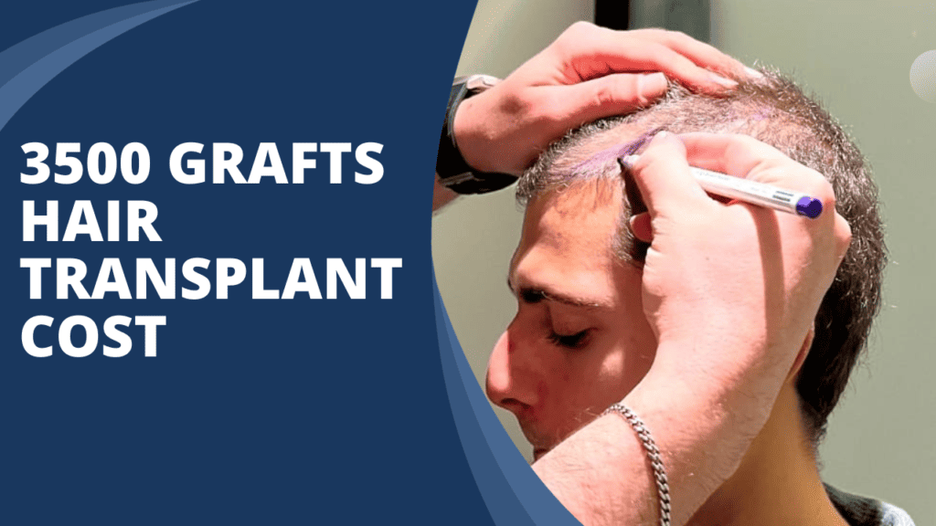 3500 grafts hair transplant cost