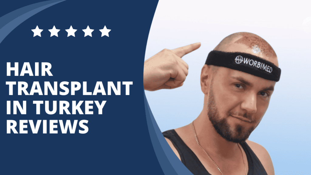 hair transplant in turkey reviews