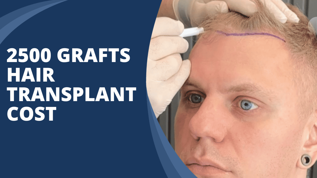 2500 grafts hair transplant cost