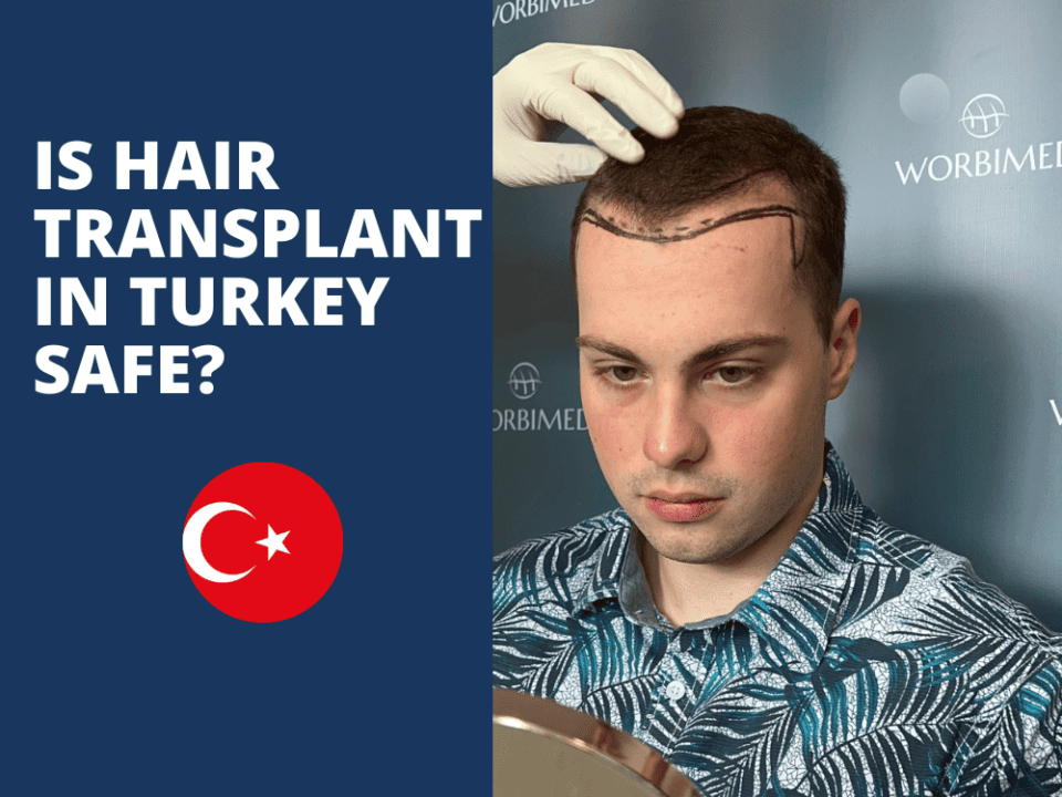 Is hair transplant in Turkey safe?