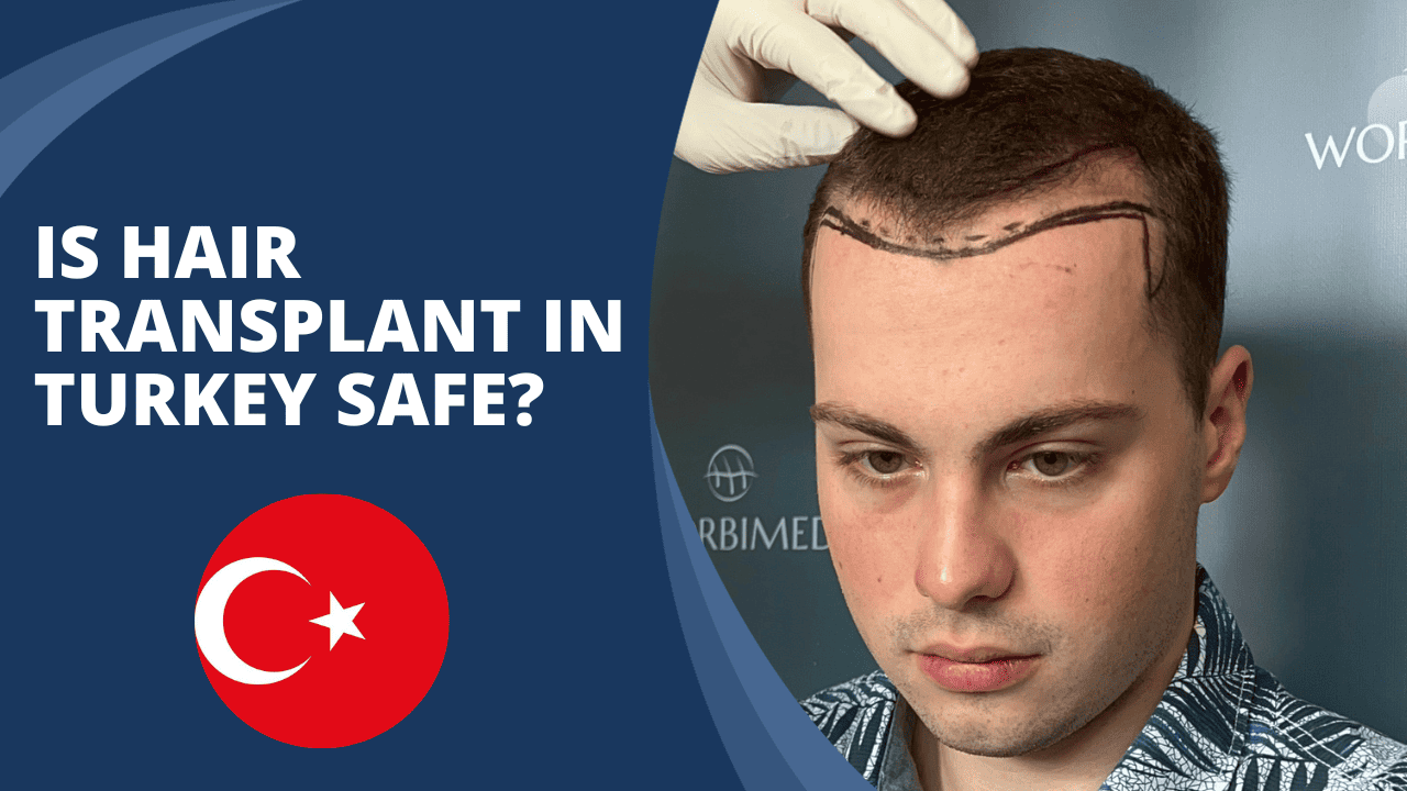 Is hair transplant in Turkey safe