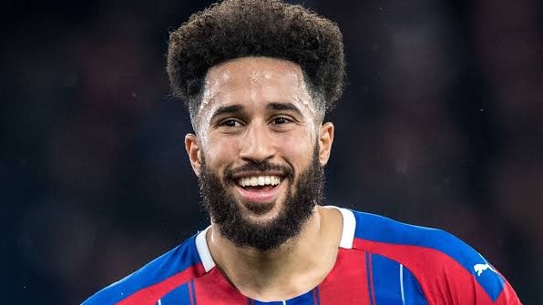 Andros Townsend after a hair transplant