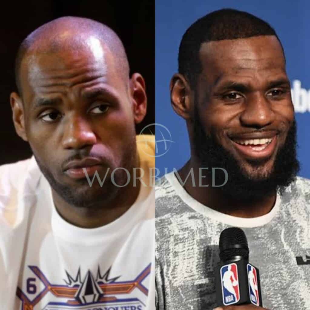 LeBron James hair before and after