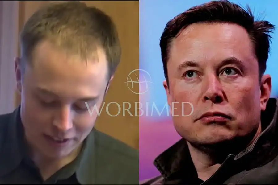 elon-musk-before