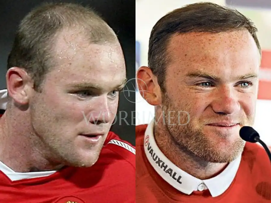 Rooney hair 