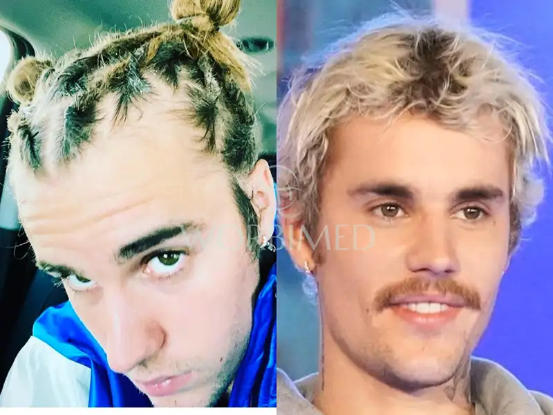 Justin Bieber hair