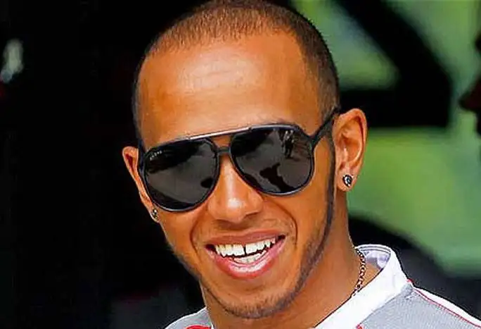 Lewis Hamilton before hair transplant