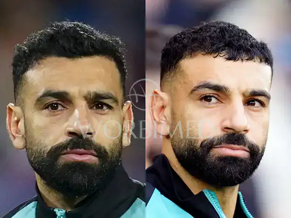 Mo Salah haircut now