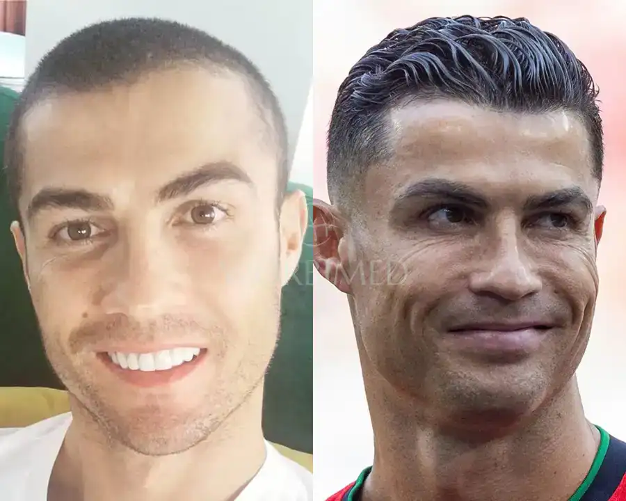 cristiano ronaldo hair