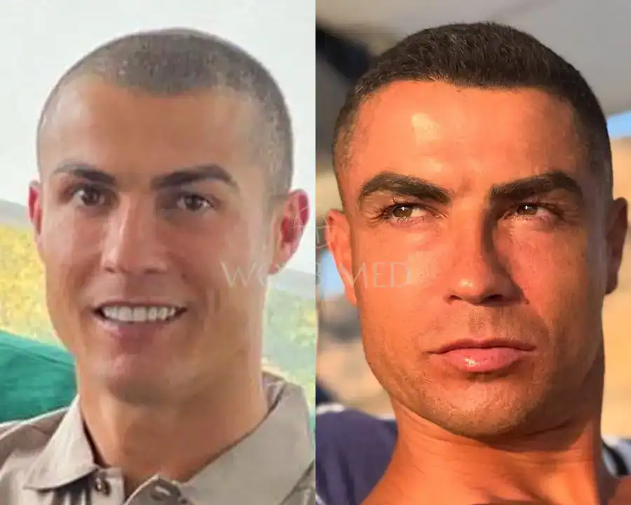 cristiano ronaldo hair timeline